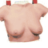 着用式乳房検診シミュレーター